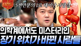 장기가 정반대에 위치한 '좌우 바뀜증'😱 의학적으로 설명 불가한 신비로운 인체 이야기❗| #프리한19 #티전드