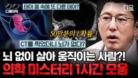 현대 의학 기술로는 설명불가! 50만 분의 1 확률로 일어나는 희귀한 메디컬 불가사의 | #프리한19 #디제이픽