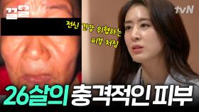 20대도 망쳐놓는 무서운 피부 위협😱 피부를 지키려면 이것이 필요하다?! | 프리한닥터W