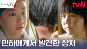/충격/ 박소이, 기소유의 몸에서 발견한 학대의 흔적?! | tvN 230820 방송