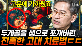 치매를 앓던 노인을 마녀사냥했던 과거 ㄷㄷ 치료를 핑계로 정신질환자를 학대한 인류😱 | #벌거벗은세계사