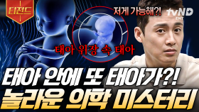 과학적으로 설명 불가능❌ 의학계를 놀라게 한 전 세계의 의학 미스터리 | #프리한19 #티전드