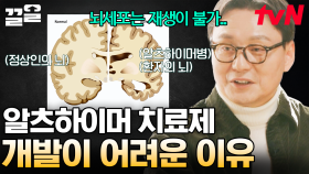 기억이 사라지는 병, 알츠하이머... 아직까지 치료제를 개발하기 어려운 결정적인 이유? | 알쓸인잡