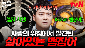 살아있는 뱀장어가 사람 위장 속에서 발견된 이유는?! 경악을 금치 못하는 사람들의 기이한 행동들.zip | 프리한19