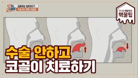 전문의가 전하는 수술 없이 '코골이 치료법'