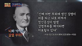 '국소감염치료' 정신질환 원인 세균 감염으로 본 치료법(0;;)