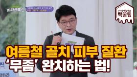 여름철 골치 피부질환 '무좀' 완치 법 공개!