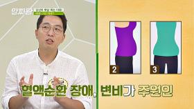 뱃살 모양으로 알아보는 ＂내가 살이 찌는 이유와 원인＂