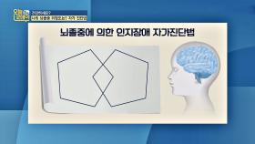 나의 뇌졸중 위험도는? 뇌졸중에 의한 인지장애 자가 진단법