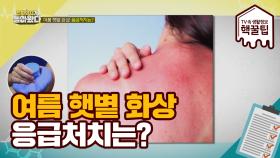 '여름 햇볕 화상 & 빠진 치아 살리기' 응급 처치법!