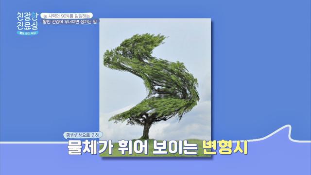 실명 원인 1위 [황반변성]이 생기면 벌어지는 일😱