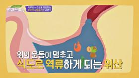 역류성 식도염을 유발하는 잘못된 생활습관 #야식