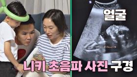 (신기❤️) 세 가족이 함께 보는 경미♡형빈 부부의 초음파 사진 구경 | JTBC 201018 방송