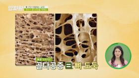 '뼈 도둑' 골다공증 발생에 특히 취약한 갱년기 여성😭 | JTBC 200924 방송