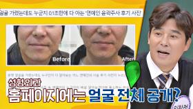 성형외과 홈페이지에 임창정의 '윤곽 주사 후기 사진' 걸린 이유ㅋㅋ | JTBC 201010 방송