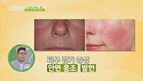 증상들로 알아보는 '피부 감기'의 위험성🚨 #환절기 | JTBC 20200917 방송
