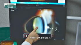 노안과 비슷한 증상의 '백내장' 늦기 전에 치료 필수🚨 | JTBC 201129 방송