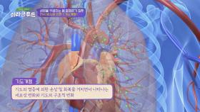 천식을 방치하여 생기는 [기도 개형], 폐렴이 동반될 가능성까지 높다고..! | JTBC 210417 방송