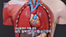 동맥경화가 불러오는 질환?! 소리 없는 살인자, '심근경색' | JTBC 210517 방송