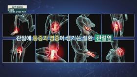 염증이 생기며 뼈의 변형이 되는 '퇴행성 관절염' | JTBC 210704 방송