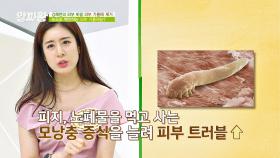 과도한 피지 분비👉 피부 속 모낭충을 살게 하는 원인?!😱 | JTBC 210819 방송