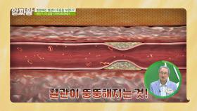 혈관도 살이 찐다?! 소리 없이 목숨을 위협하는 '혈관 나잇살'💧 | JTBC 210909 방송