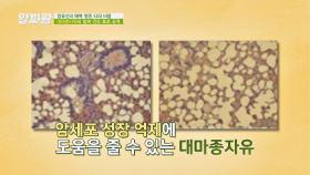 [알짜 건강 효과] 암세포 성장을 막아주는 대마종자유👍🏻 | JTBC 210930 방송