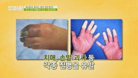 치매, 손발 괴사 등 각종 질병을 유발하는 '혈관 기름살' | JTBC 211014 방송
