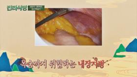 내 몸의 시한폭탄💥, 목숨까지 위협하는 '내장지방' | JTBC 220421 방송