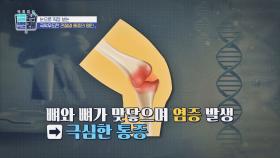 한 번 닳은 연골은 재생 불가❌ '관절염' 통증의 원인은? | JTBC 220930 방송