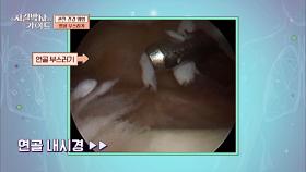 소~중한 3mm 연골 '콘드로이친'으로 지키자↗↗ | JTBC 240204 방송