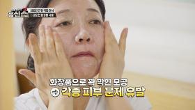 과도한 화장품 사용, 오히려 피부 문제를 유발한다!? | JTBC 240617 방송