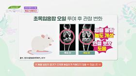 통증 브레이크! 지긋지긋한 관절 통증 잡아주는 