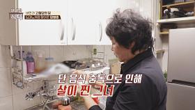 비만과 고혈당의 덫💥 건강이 무너진 그녀의 사연은? | JTBC 241221 방송