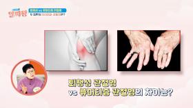 퇴행성 vs 류머티즘, 극심한 통증을 부르는 두 관절염의 차이는? | JTBC 250130 방송