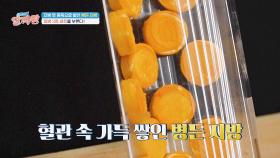 몸에 쌓여가는 병든 지방😵 질병 3종 세트로 건강을 무너트린다! | JTBC 250227 방송