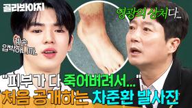 ＂영광의 상처다 진짜...＂ 부상 딛고 일어난 피겨 프린스 ✨차준환의 발 사진✨ 첫 공개｜아는 형님｜JTBC 250308 방송