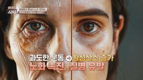 강도 높은 운동이 노화를 촉진한다고?!😲 운동량과 활성산소의 연관성! | JTBC 250426 방송
