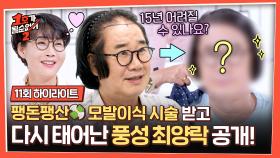 [하이라이트] 팽현숙 평생소원 성취✨ 풍성하게 다시 태어난 최양락 모발이식 전→후 공개! | JTBC 250807 방송