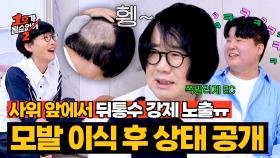 사위가 궁금한 건 보여줘야지! 텅 빈 뒤통수까지 공개한 최양락💦 | JTBC 250814 방송