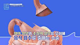 체중 감량을 위해 