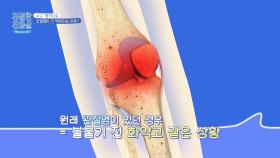 일상적인 동작도 불가😭 