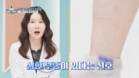 혈관+치매 위험까지 부른다! 체내 알부민 부족 자가 진단법 | JTBC 251117 방송