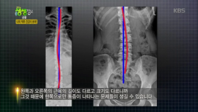 너의 척추 건강이 보여!