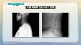 목 건강을 위해 눈높이를 맞추고 앉는 자세를 바르게!