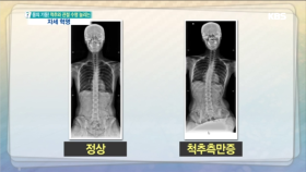 나쁜 자세는 몸의 균형을 깨뜨리고 체형을 망친다