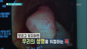 췌장&담낭은 초음파를 통해, 위&대장은 내시경을 통해 검사