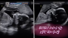 옆모습 예술! 율희 뱃속 쌍둥이!