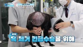세호의 혹 제거 긴급수술! 혹 무게만 2KG?! | KBS 201126 방송
