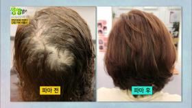 넌 내게 볼륨감을 줬어♨ 파마로 탈모를 커버한다! 30년 경력 단점 커버 미용사 | KBS 210427 방송
